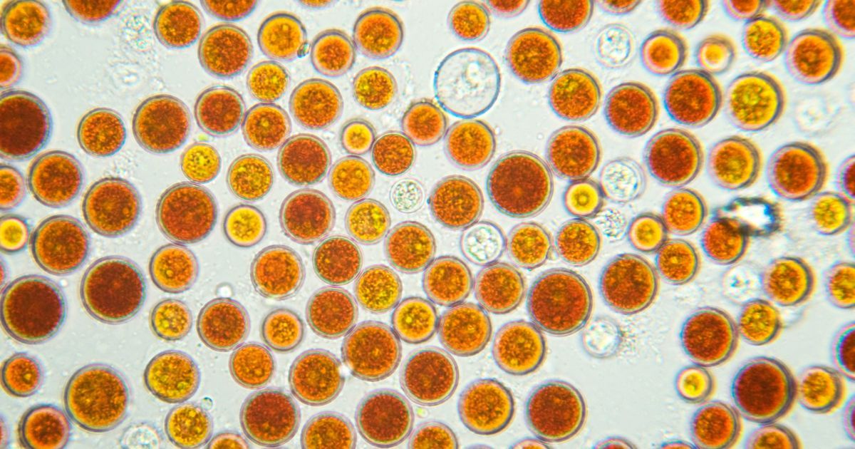 Algae (haematococcus pluvialis) under a microscope.